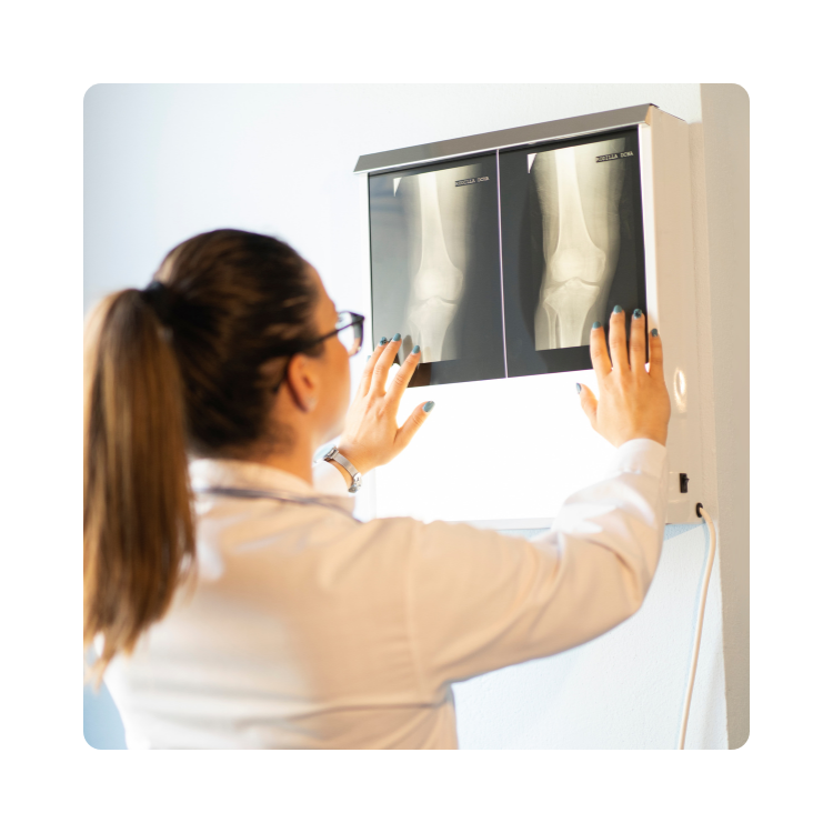 Lekarka analizuje zdjęcia rentgenowskie kolan na negatoskopie w gabinecie ortopedycznym.