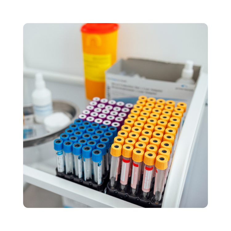 Probówki z materiałem do badań laboratoryjnych przygotowane do analizy